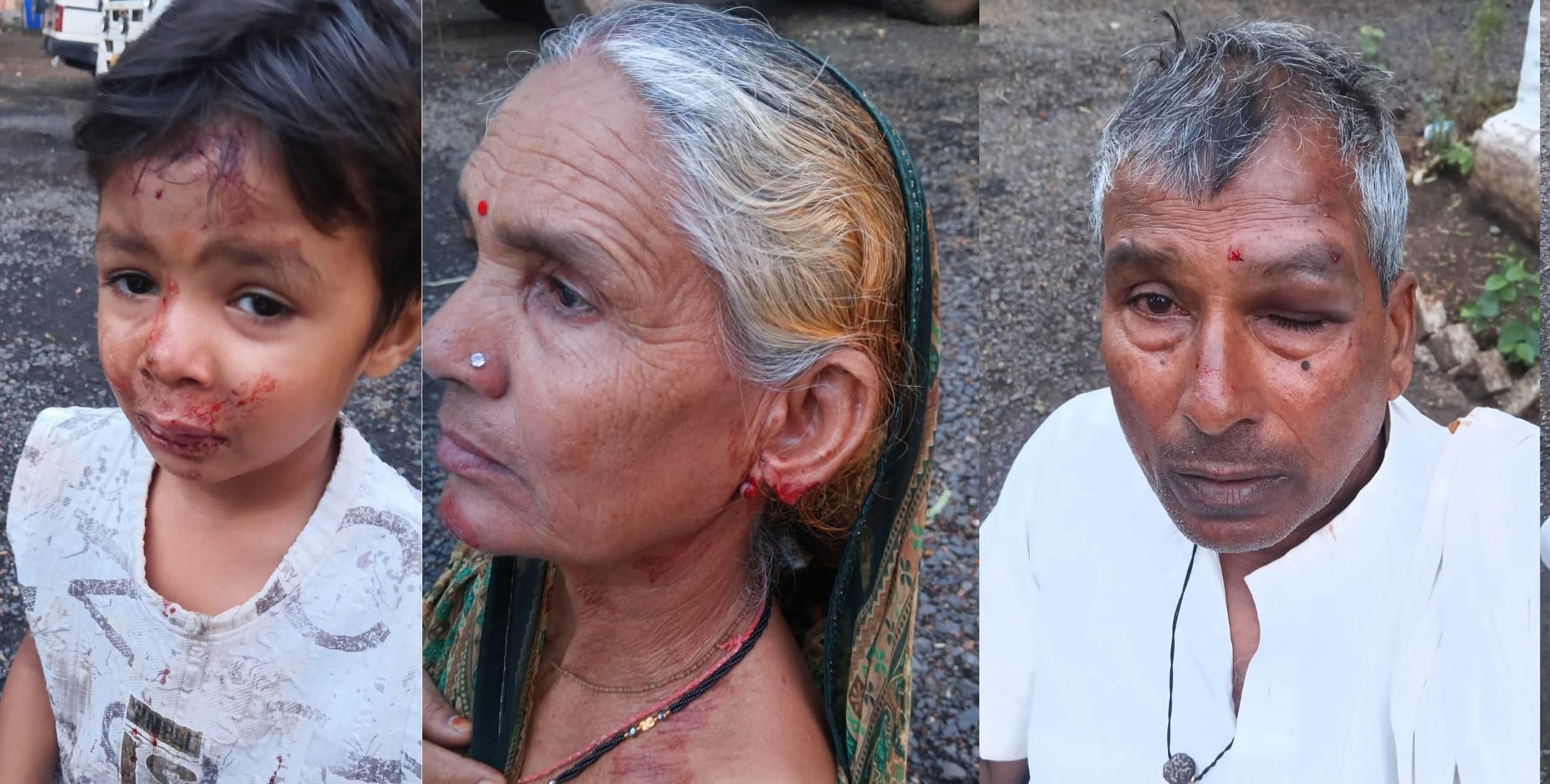 तीन लुटेरों ने चलती बाइक से महिला के कान के सोने के टॉप्स लूटे, तीन लोग घायल 