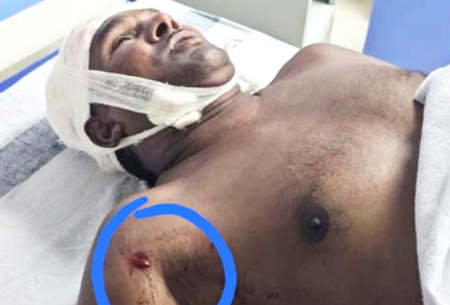 ईदगाह बाड़ी में गोलीबारी, एक गोली कंधे पर लगी, दूसरी युवक के सिर को छूकर निकली