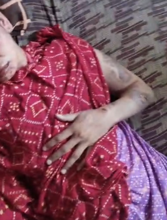 चरित्र शंका में आरक्षक पति ने पत्नी को गर्म प्रेस से 7 बार दागा, हाथ-पैर बांधकर की पिटाई, आरक्षक गिरफ्तार